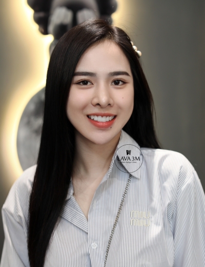 Răng sứ Diamond